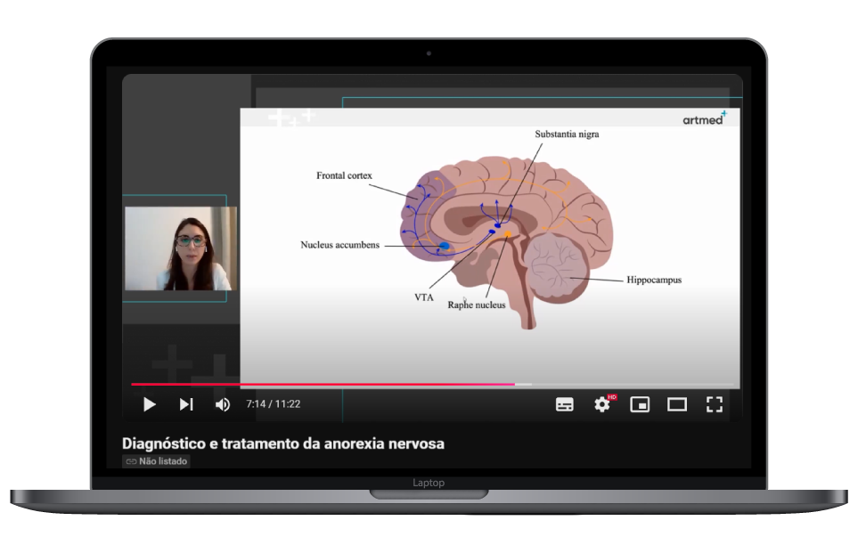 0Artmed-Org-Mat_Rico-2412Anorexia-nervosa-mockup-1