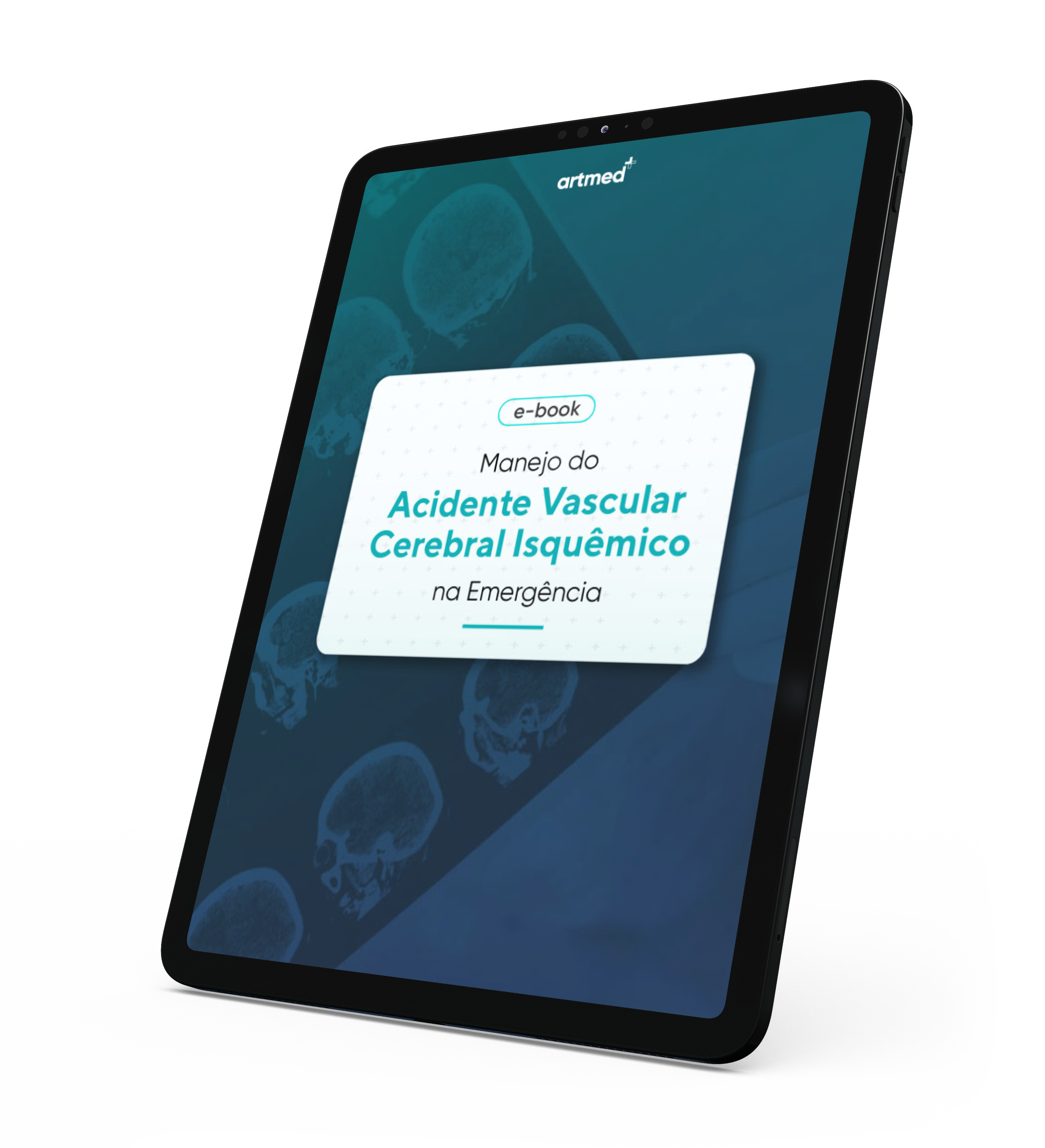 0Artmed-Org-Mat_Rico-2510Manejo-AVCI-mockup-1