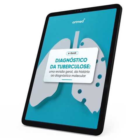 Diagnóstico da tuberculose