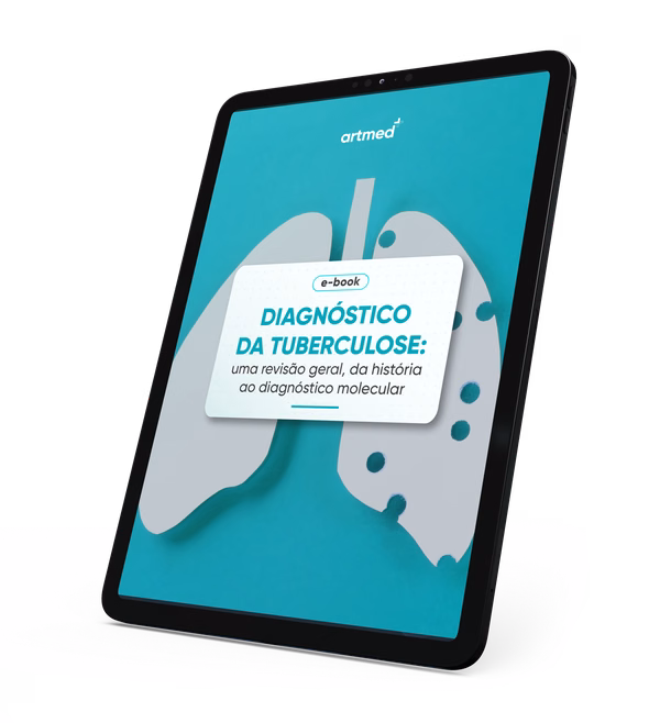 Diagnóstico da tuberculose